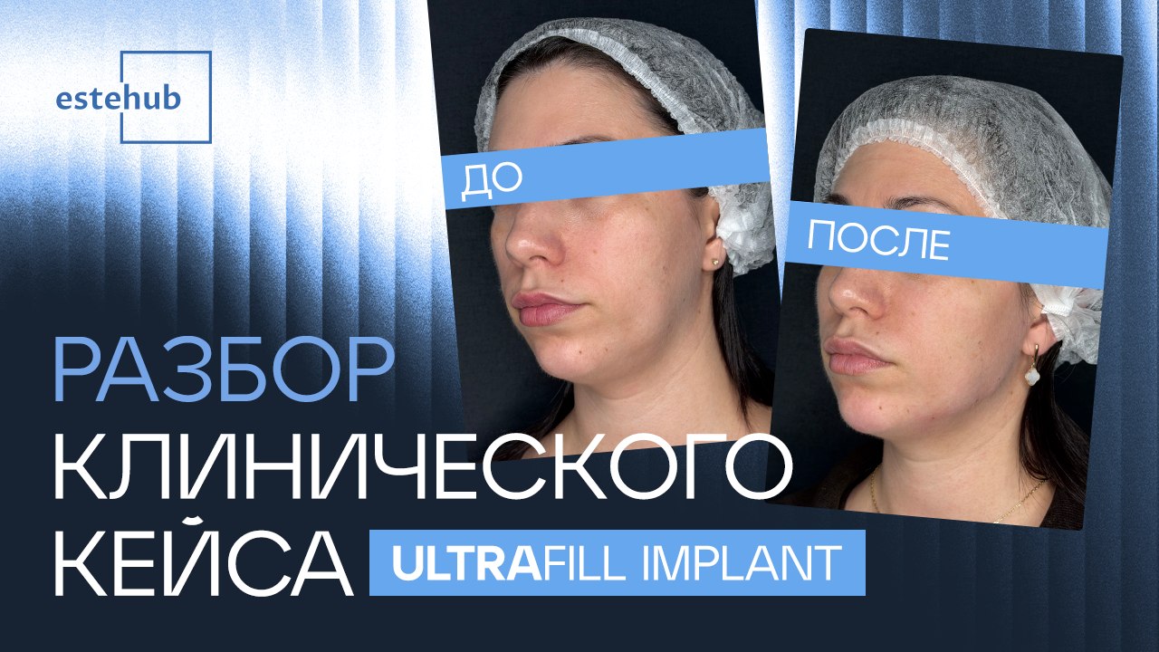 Эстехаб