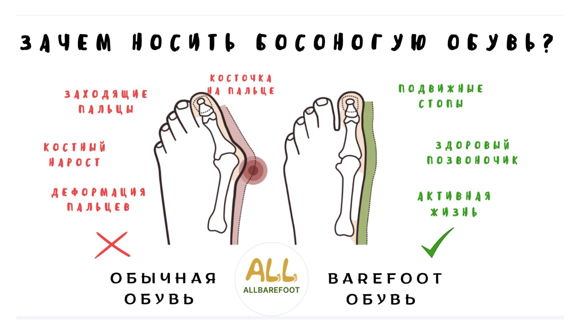 📣ALLBarefoot👣 Босоногая обувь из Европы