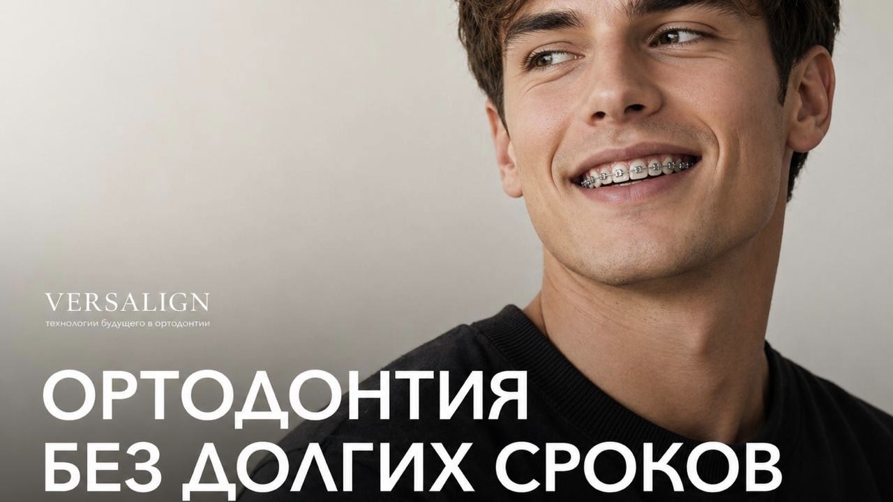 Versalign | Гибридная ортодонтия 3-6 мес.