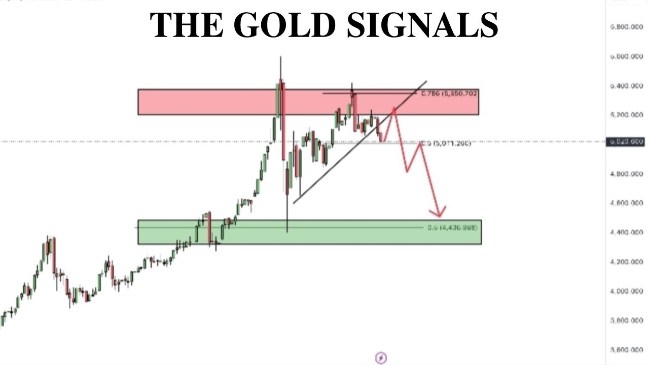 Xauusd Gold _Mastar
